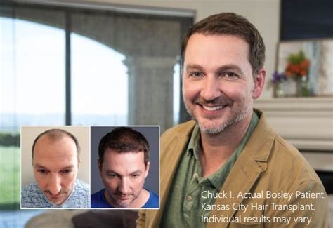 hair transplants st louis|Bosley Kansas City .
